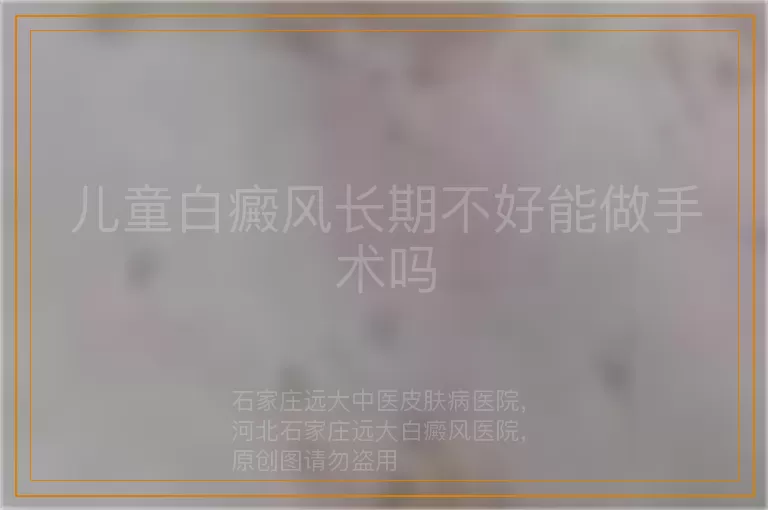 儿童白癜风长期不好能做手术吗