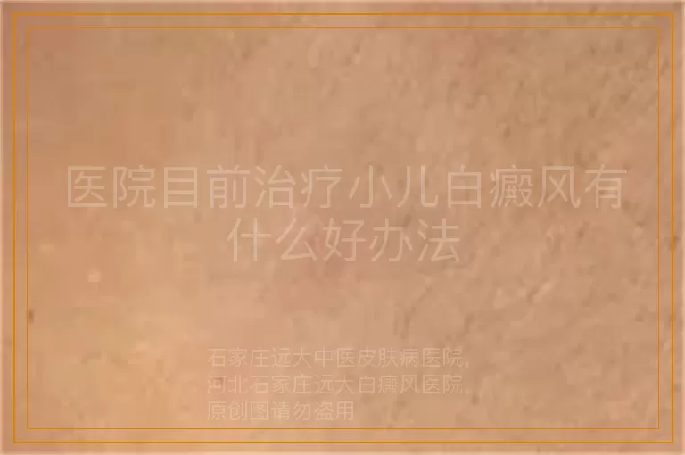 医院目前治疗小儿白癜风有什么好办法