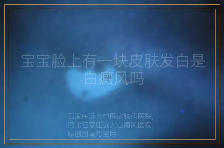 宝宝脸上有一块皮肤发白是白癜风吗
