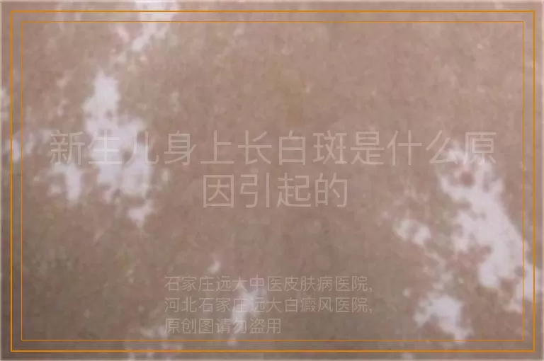 新生儿身上长白斑是什么原因引起的