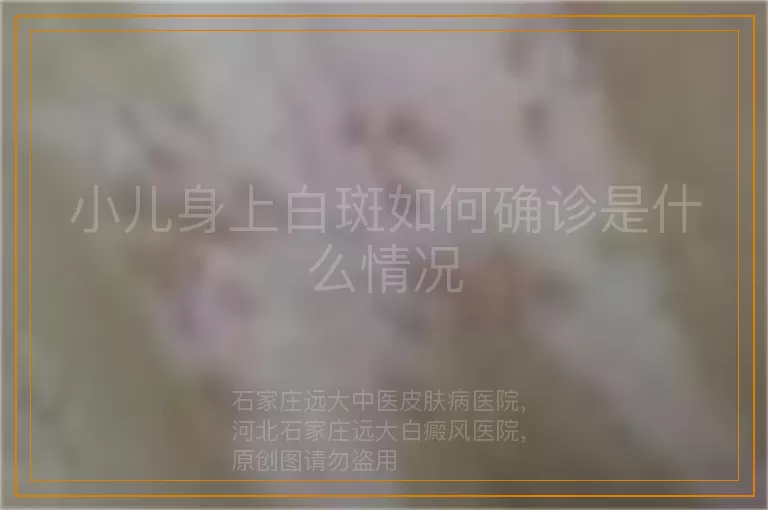 小儿身上白斑如何确诊是什么情况