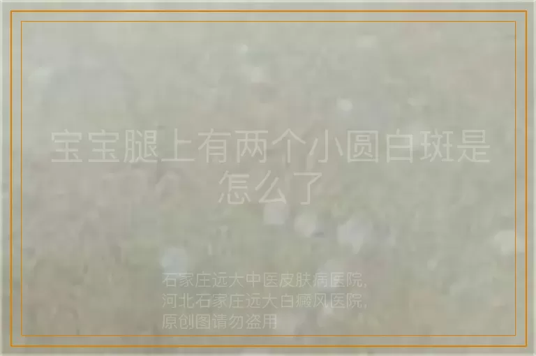 宝宝腿上有两个小圆白斑是怎么了