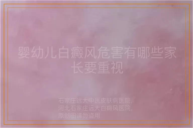 婴幼儿白癜风危害有哪些家长要重视