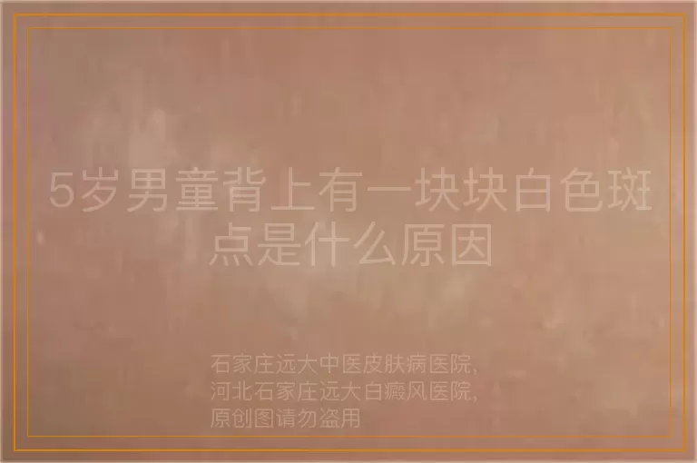 5岁男童背上有一块块白色斑点是什么原因