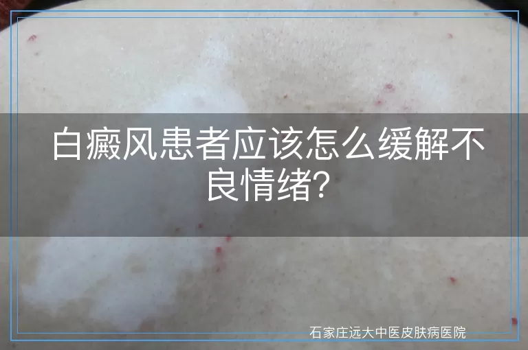 白癜风患者应该怎么缓解不良情绪？