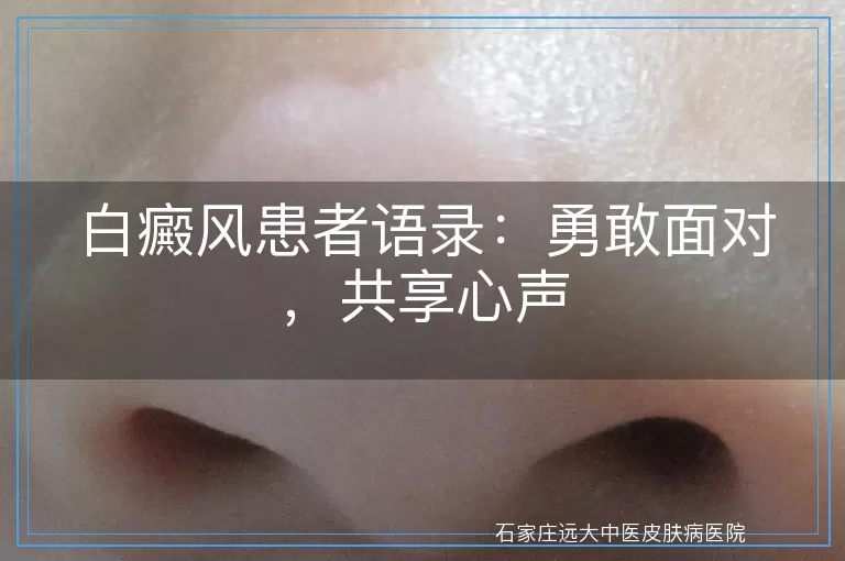 白癜风患者语录：勇敢面对，共享心声