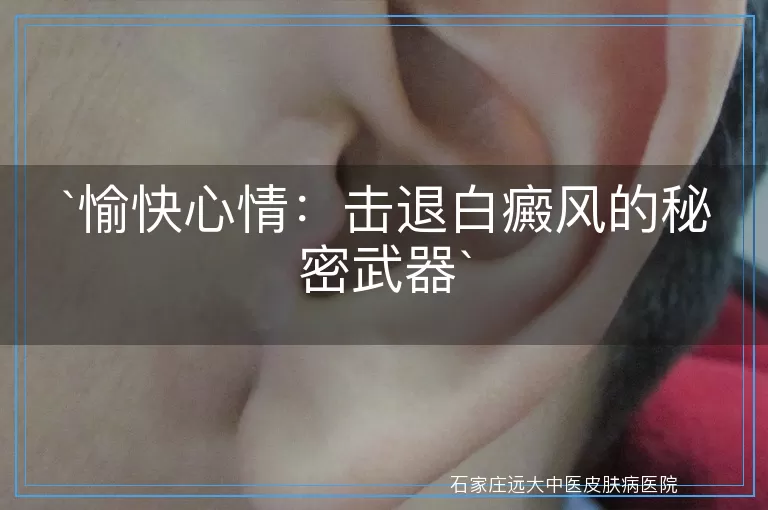 愉快心情：击退白癜风的秘密武器
