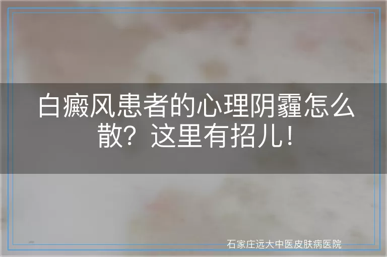 白癜风患者的心理阴霾怎么散？这里有招儿！