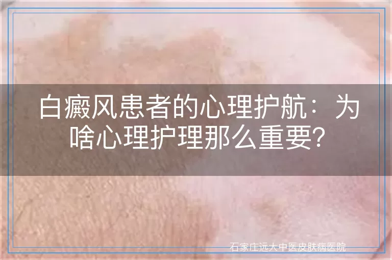 白癜风患者的心理护航：为啥心理护理那么重要？