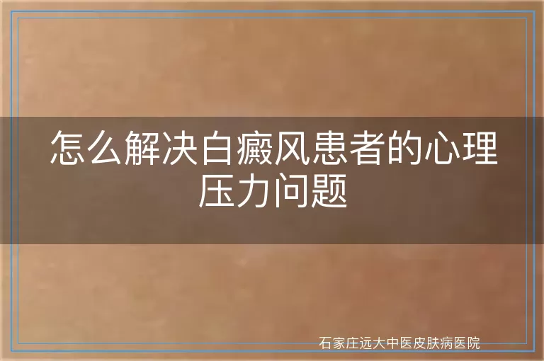 怎么解决白癜风患者的心理压力问题