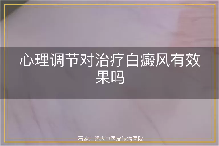 心理调节对治疗白癜风有效果吗