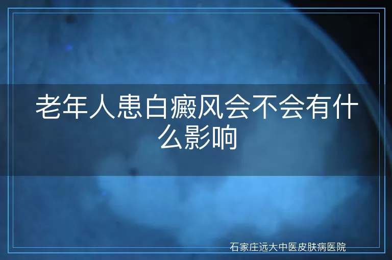 老年人患白癜风会不会有什么影响