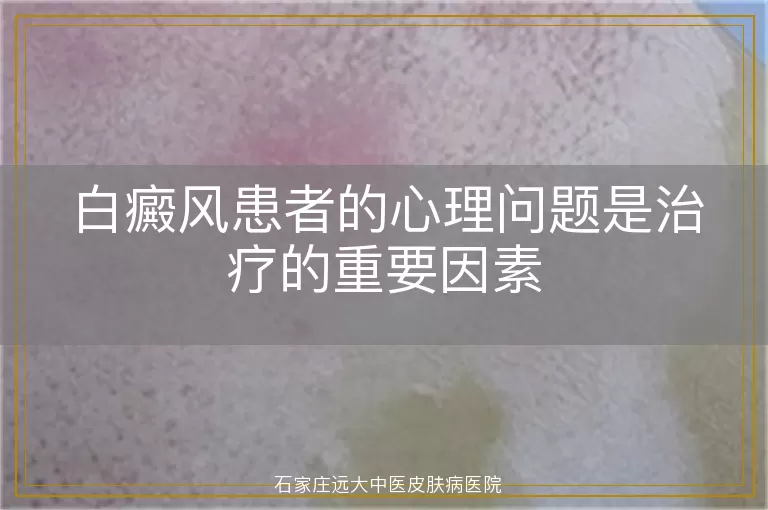 白癜风患者的心理问题是治疗的重要因素