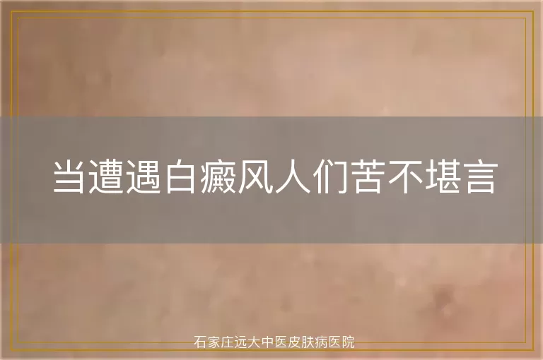 当遭遇白癜风人们苦不堪言