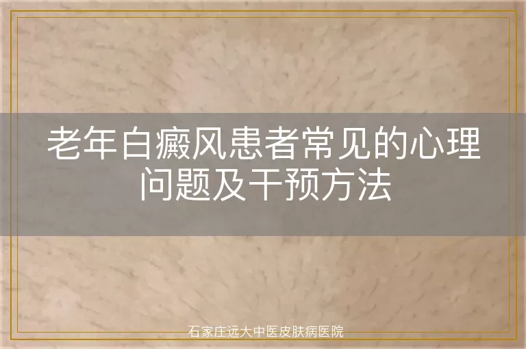 老年白癜风患者常见的心理问题及干预方法