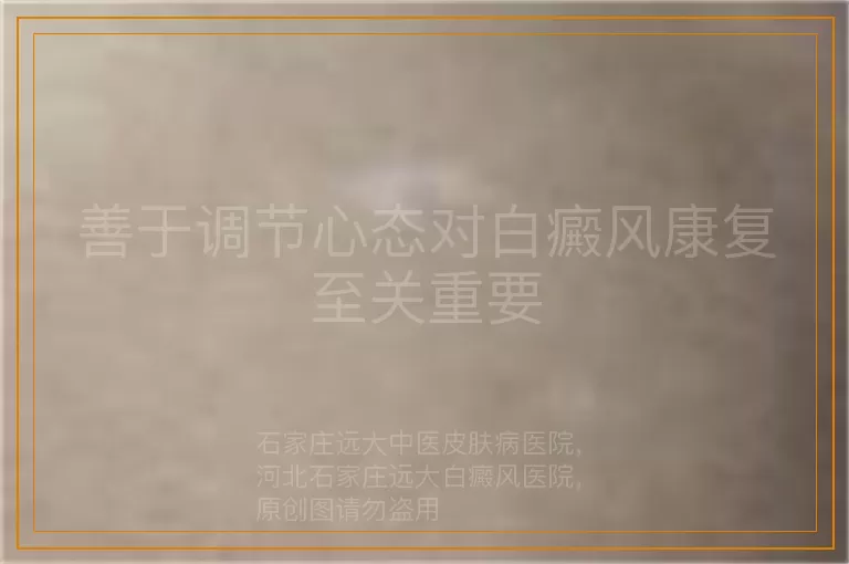 善于调节心态对白癜风康复至关重要