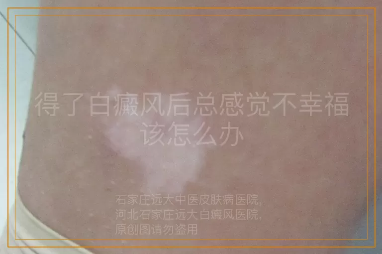 得了白癜风后总感觉不幸福该怎么办
