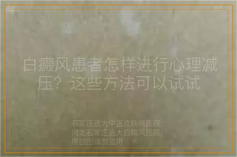 白癜风患者怎样进行心理减压？这些方法可以试试