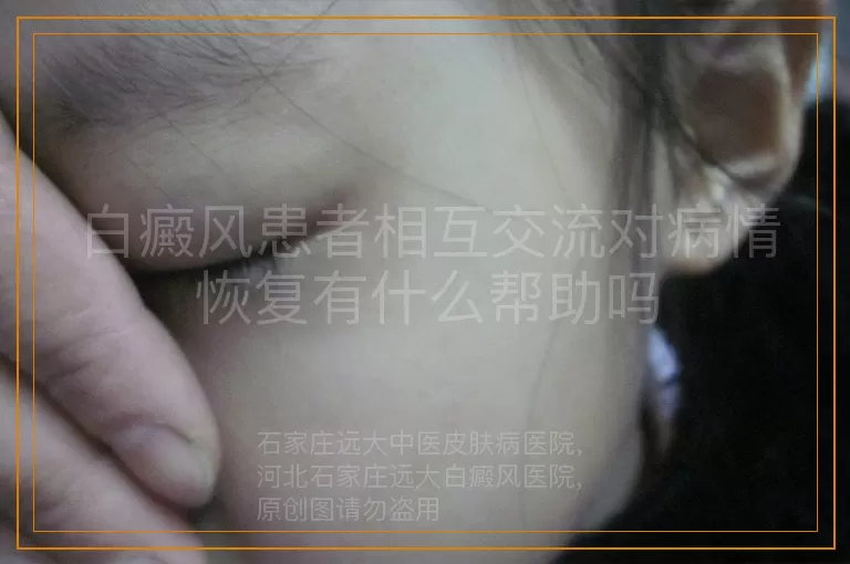 白癜风患者相互交流对病情恢复有什么帮助吗