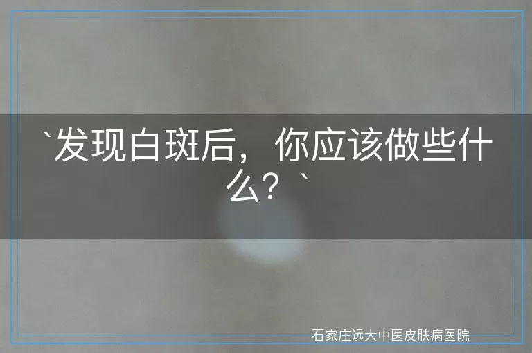 发现白斑后，你应该做些什么？