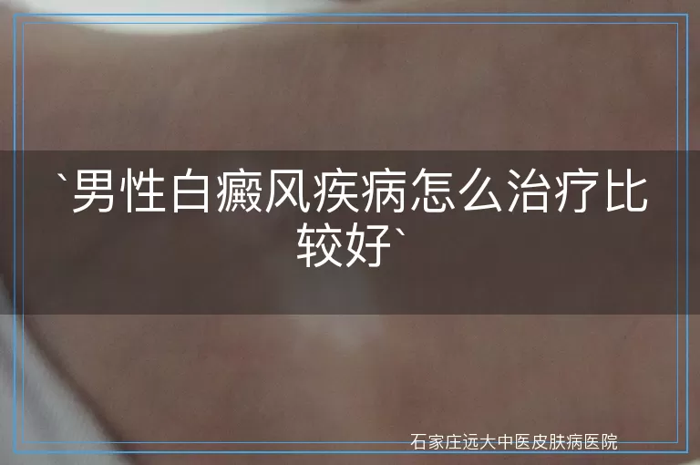 男性白癜风疾病怎么治疗比较好
