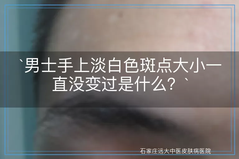 男士手上淡白色斑点大小一直没变过是什么？