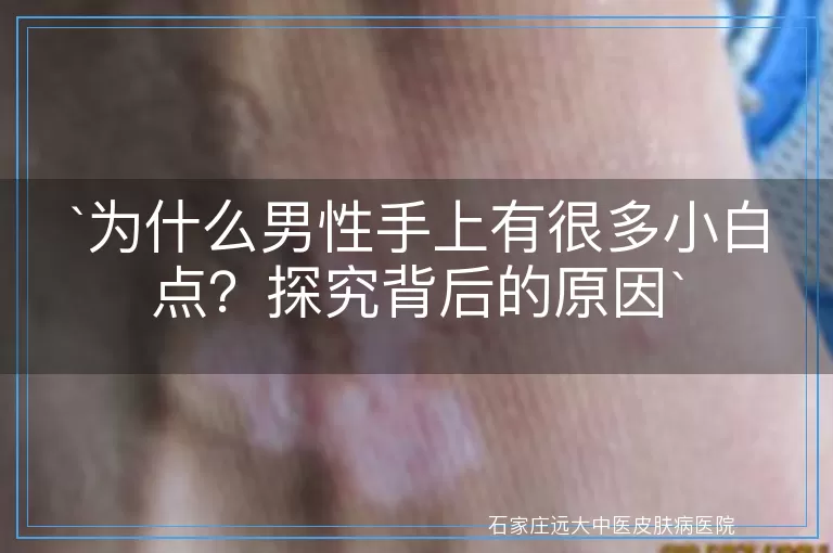 为什么男性手上有很多小白点？探究背后的原因