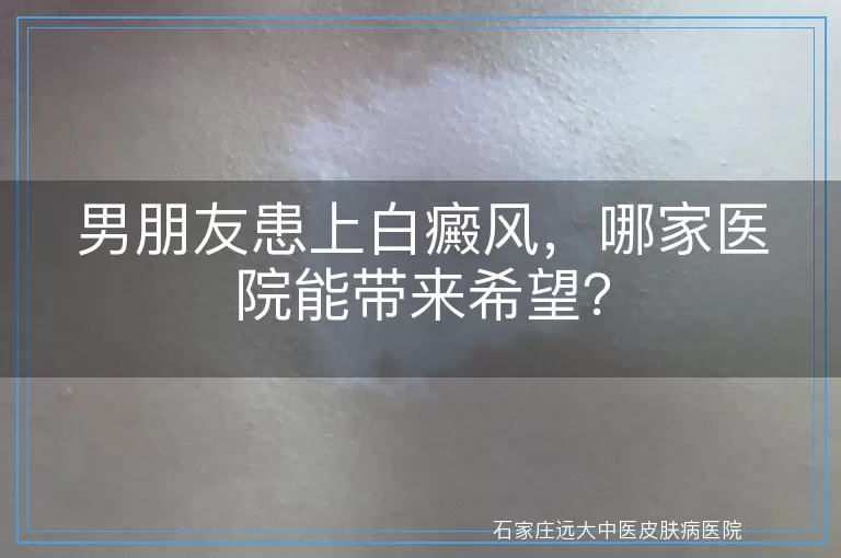 男朋友患上白癜风，哪家医院能带来希望？