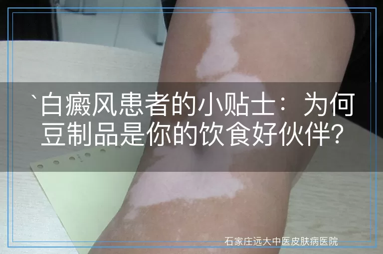 白癜风患者的小贴士：为何豆制品是你的饮食好伙伴？