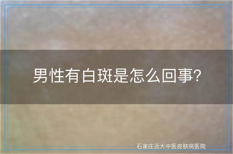 男性有白斑是怎么回事？