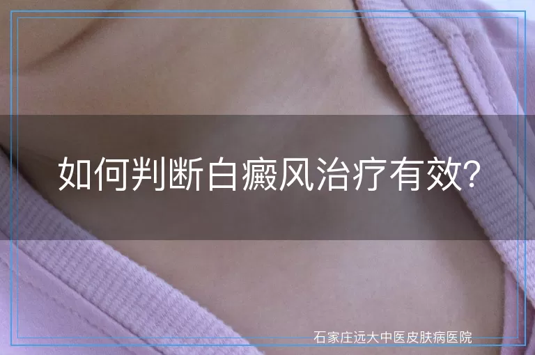 如何判断白癜风治疗有效？