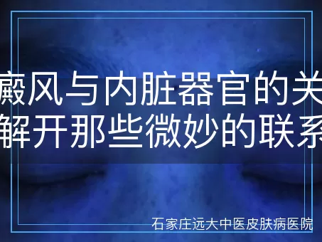 白癜风与内脏器官的关系：解开那些微妙的联系