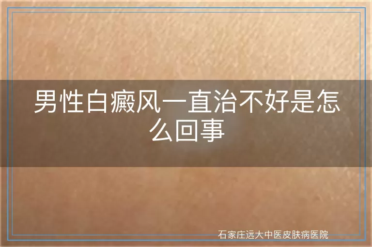 男性白癜风一直治不好是怎么回事