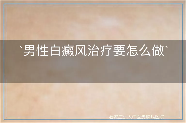 男性白癜风治疗要怎么做