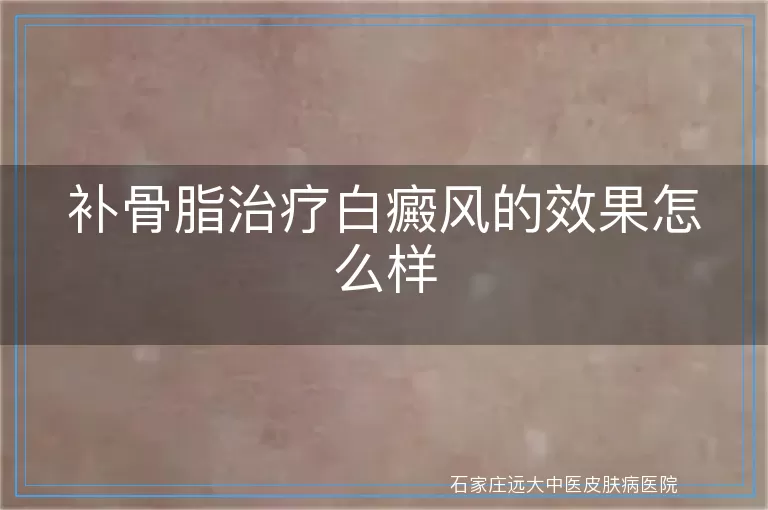 补骨脂治疗白癜风的效果怎么样