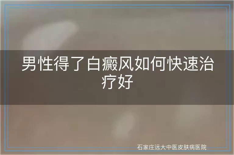 男性得了白癜风如何快速治疗好