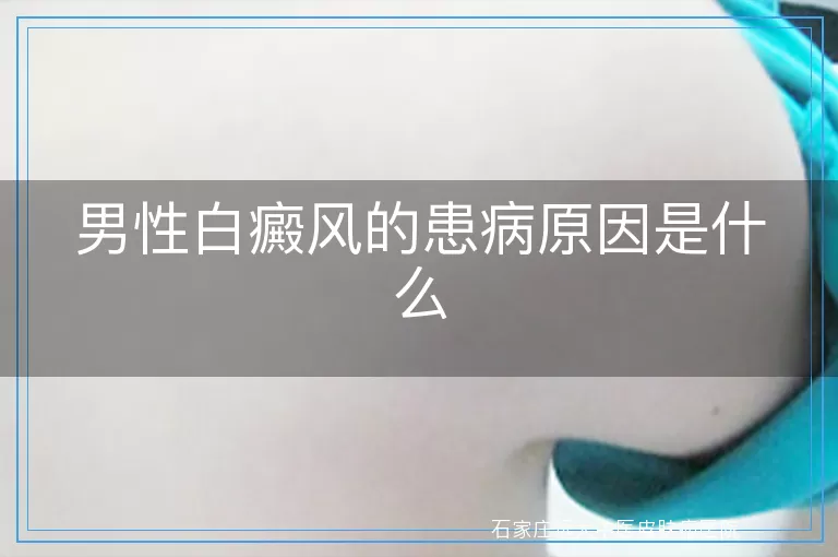 男性白癜风的患病原因是什么