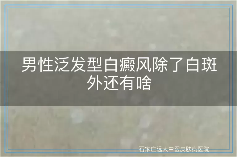 男性泛发型白癜风除了白斑外还有啥