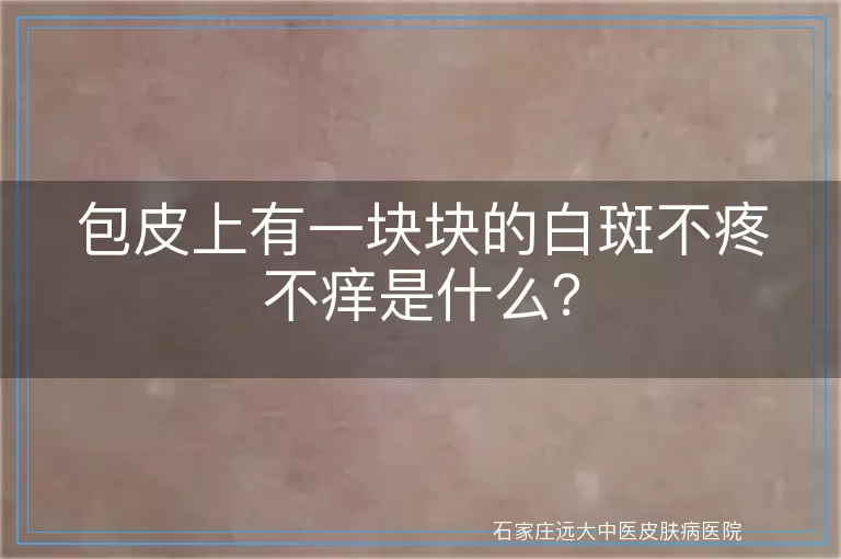包皮上有一块块的白斑不疼不痒是什么?