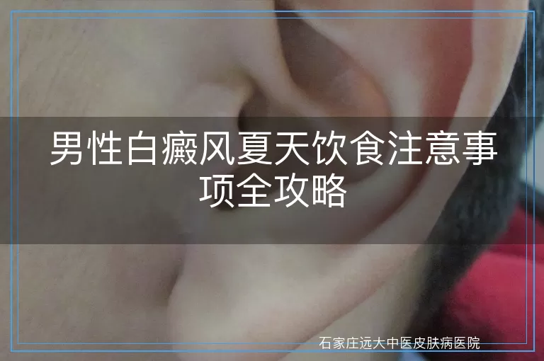 男性白癜风夏天饮食注意事项全攻略