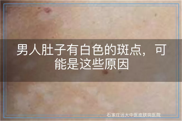男人肚子有白色的斑点,可能是这些原因