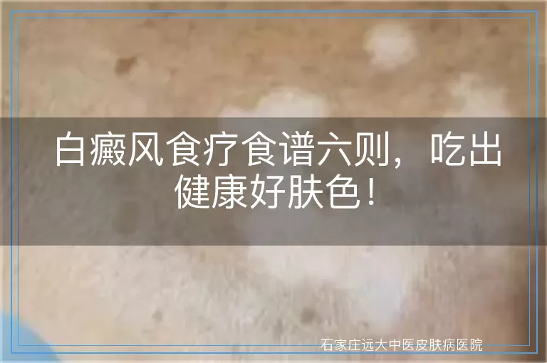 白癜风食疗食谱六则，吃出健康好肤色！