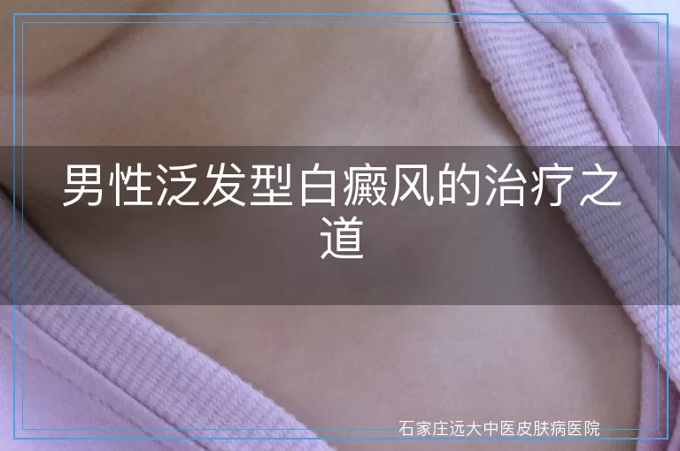 男性泛发型白癜风的治疗之道