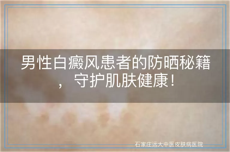 男性白癜风患者的防晒秘籍，守护肌肤健康！