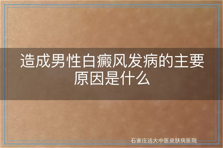 造成男性白癜风发病的主要原因是什么