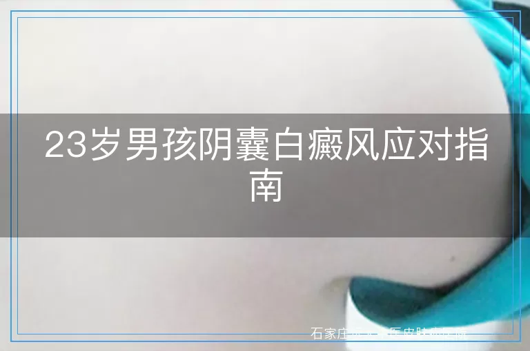 23岁男孩阴囊白癜风应对指南