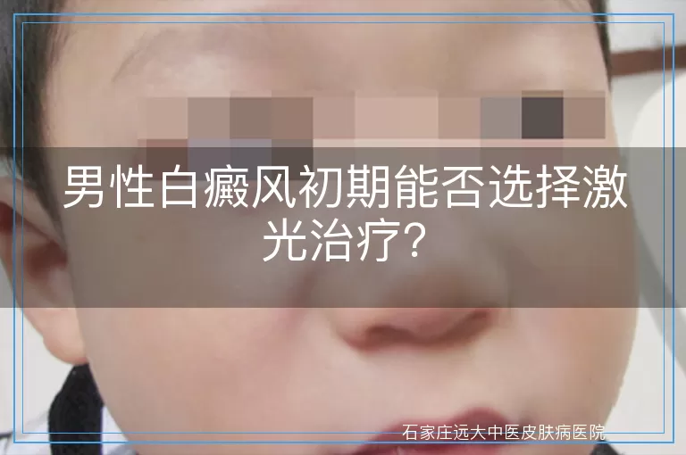 男性白癜风初期能否选择激光治疗？