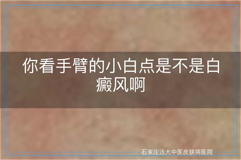 你看手臂的小白点是不是白癜风啊