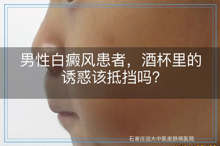 男性白癜风患者，酒杯里的诱惑该抵挡吗？