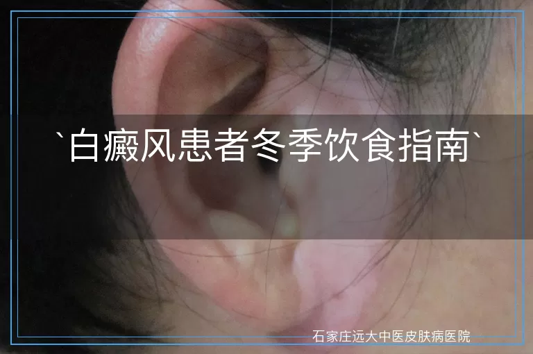 白癜风患者冬季饮食指南